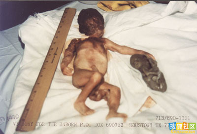 点此在新窗口浏览图片