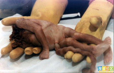 点此在新窗口浏览图片