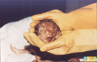 点此在新窗口浏览图片