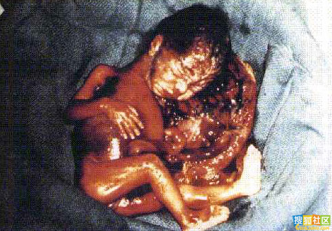 点此在新窗口浏览图片