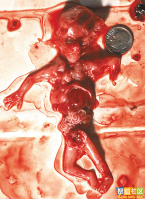 点此在新窗口浏览图片