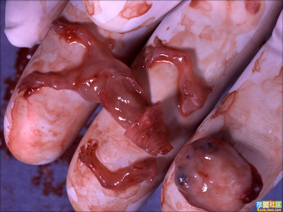 点此在新窗口浏览图片