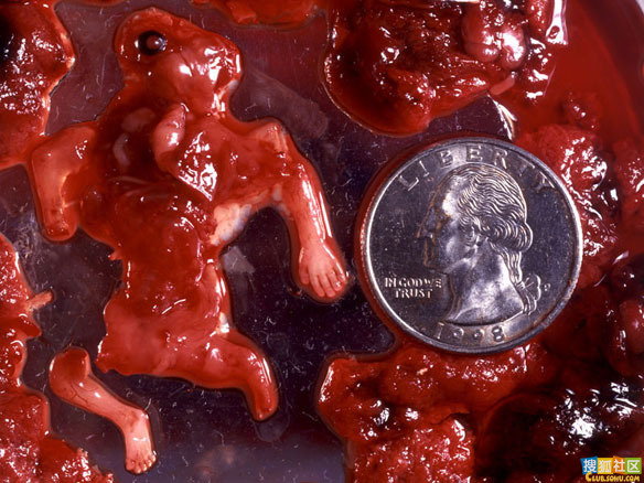 点此在新窗口浏览图片