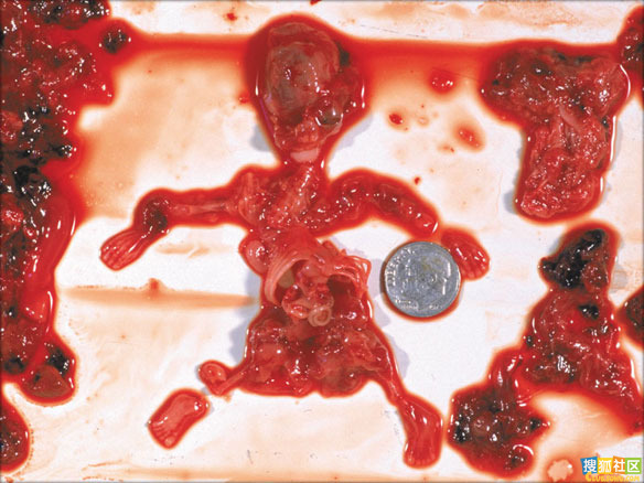 点此在新窗口浏览图片