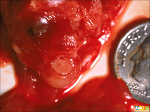 点此在新窗口浏览图片