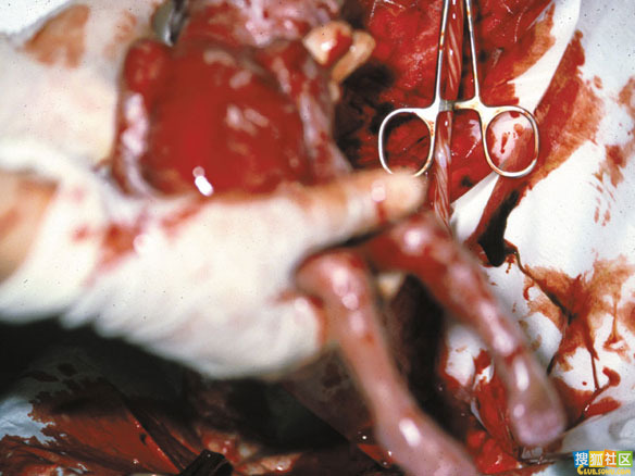 点此在新窗口浏览图片