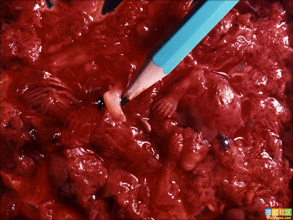 点此在新窗口浏览图片