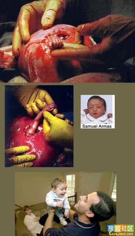 点此在新窗口浏览图片