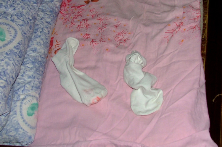 艾师傅的袜子被血染红了