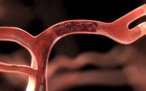 14种有效提高血管健康的食物 14种有效提高血管健康的食物